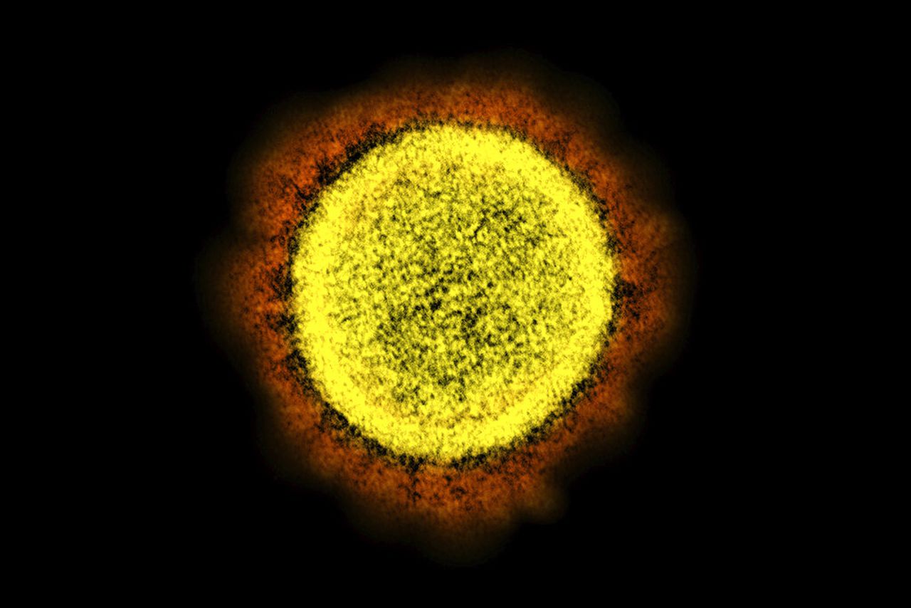 The BA.5 variant is spreading, and your COVID immunity might be gone because of it
